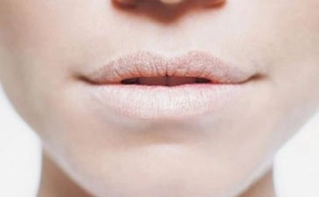 Dudak Dikişi Dudaktaki Dikiş İzi Nasıl Geçer?